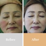 Omnilux Contour Face Mask - Image 13