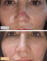 Omnilux Contour Face Mask - Image 11