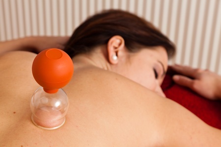 9199323 - relaxation, peace and well-being through massage. cupping massage