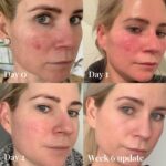 Omnilux Contour Face Mask - Image 10