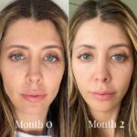Omnilux Contour Face Mask - Image 12