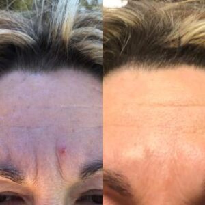 Chi-statt-Botox-Feedback-1.jpg