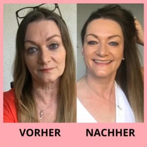 Chi-statt-Botox-Feedback3.png