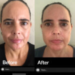 Omnilux Contour Face Mask - Image 2